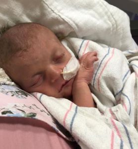 Sleeping newborn with NG tube inserted