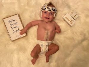 Smiling baby in diaper and helmet