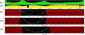Research and Future Direction for Multimodal Monitoring