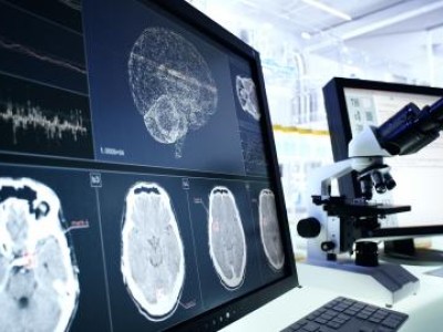 Brain scan imaging on computer screen
